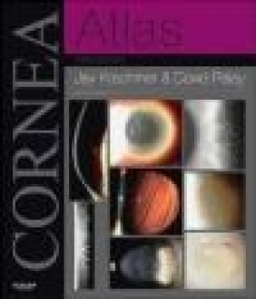 Cornea Atlas David A. Palay, Jay H. Krachmer