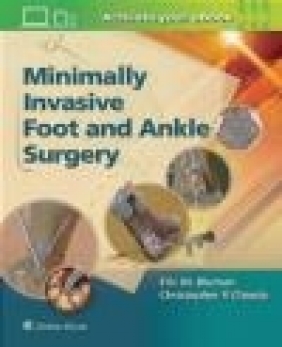 Minimally Invasive Foot Eric Bluman, Christopher Chiodo