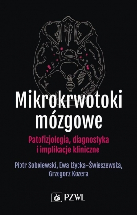 Mikrokrwotoki mózgowe - Sobolewski Piotr, Iżycka-Świeszewska Ewa , Kozera Grzegorz
