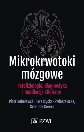 Mikrokrwotoki mózgowe - Piotr Sobolewski, Ewa Iżycka-Świeszewska, Grzegorz Kozera