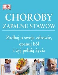 Choroby zapalne stawów