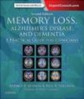 Memory Loss, Alzheimer's Disease, and Dementia Paul Solomon, Andrew Budson