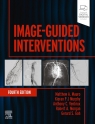 Image-Guided Interventions Opracowanie zbiorowe