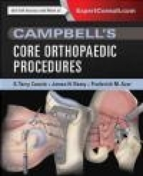 Campbell's Core Orthopaedic Procedures Frederick Azar, James Beaty, Terry Canale