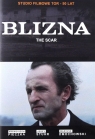 Blizna DVD