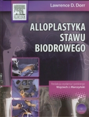 Alloplastyka stawu biodrowego z płytą DVD - Dorr Lawrence D.