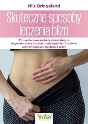 Skuteczne sposoby leczenia blizn - Nils Bringeland