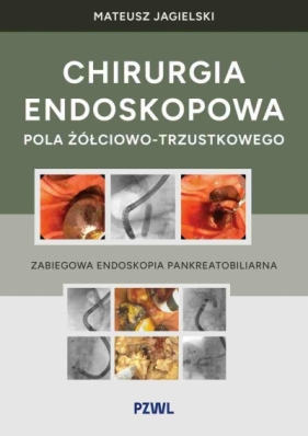 Chirurgia endoskopowa pola żółciowo-trzustkowego. Zabiegowa endoskopia pankreatobiliarna - Mateusz Jagielski