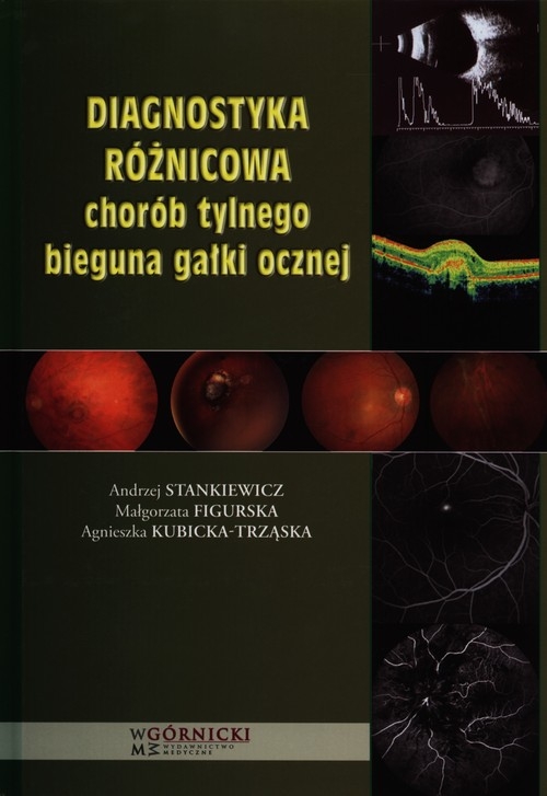 Diagnostyka różnicowa chorób tylnego bieguna gałki ocznej