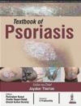 Textbook of Psoriasis