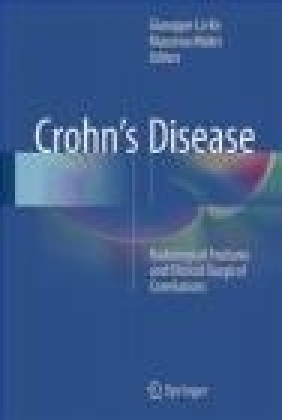 Crohn's Disease 2016