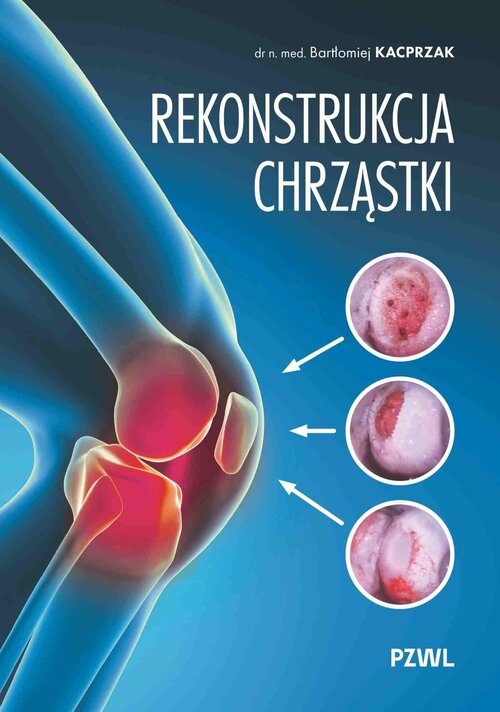 <img src='https://webimage.pl/pics/662/6/d91444B.jpg' style='height:440px' /> Rekonstrukcja chrząstki