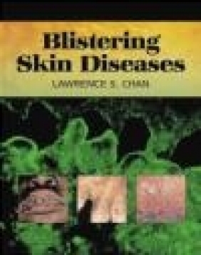 Blistering Skin Diseases Lawrence S. Chan, L Chan