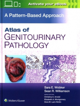 Atlas of Genitourinary Pathology - Sara E. Wobker, Sean R. Williamson