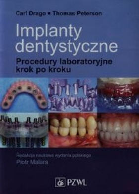Implanty dentystyczne - Peterson Thomas, Drago Carl
