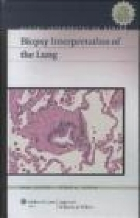 Biopsy Interpretation of the Lung Cesar A. Moran, Saul Suster, S Suster