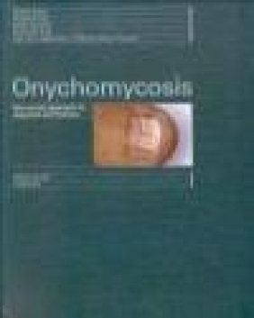 Onychomycosis Ekart Haneke, Robert Hay, R. Baran
