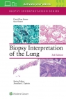 Biopsy Interpretation of the Lung David Ilan Suster