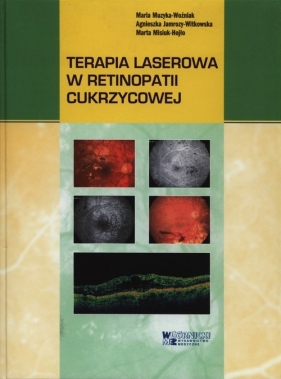 Terapia laserowa w retinopatii cukrzycowej - Maria Muzyka-Woźniak, Agnieszka Jamrozy-Witkowska, Marta Misiuk-Hojło