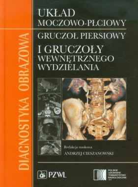 Diagnostyka obrazowa Układ moczowo-płciowy, gruczoł piersiowy i gruczoły wewnętrznego wydzielania (Uszkodzona okładka)