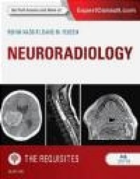Neuroradiology: The Requisites David Yousem, Rohini Nadgir