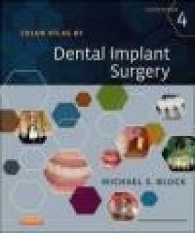 Color Atlas of Dental Implant Surgery Michael Block