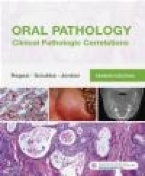 Oral Pathology