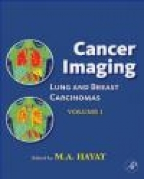 Cancer Imaging vol 1 Lung M. A. Hayat,  Hayat