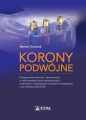 Korony podwójne - Marian Durczok