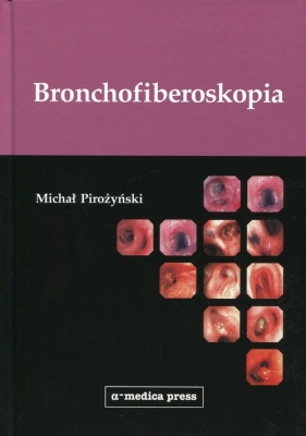 Bronchofiberoskopia - Pirożyński Michał