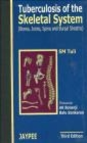 Tuberculosis of the Skeletal System 3E S.M. Tuli