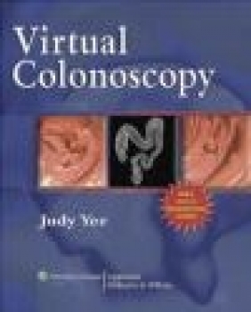 Virtual Colonoscopy Judy Yee,  Yee