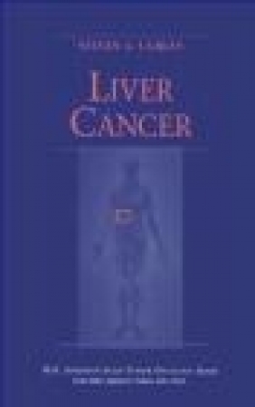 Liver Cancer Curley