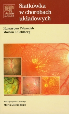 Siatkówka w chorobach układowych - Tabandeh Homayoun, Goldberg Morton F.
