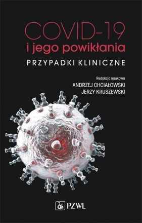 COVID-19 i jego powikłania - przypadki kliniczne - Andrzej Chciałowski, Jerzy Kruszewski