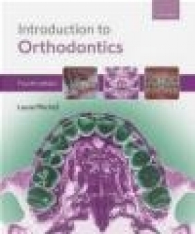 An Introduction to Orthodontics Laura Mitchell