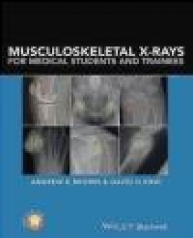 Musculoskeletal X-Rays for Medical Students David King, Andrew Brown