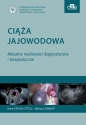 Ciąża jajowodowa Aktualne możliwości diagnostyczne i terapeutyczne - Anna Kryza-Ottou, Mariusz Zimmer