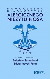 Nowoczesna diagnostyka alergicznego nieżytu nosa - Bolesław Samoliński, Edyta Krzych-Fałta