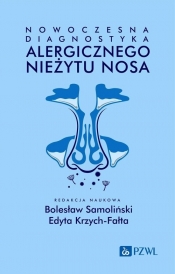Nowoczesna diagnostyka alergicznego nieżytu nosa - Krzych-Fałta Edyta, Samoliński Bolesław 