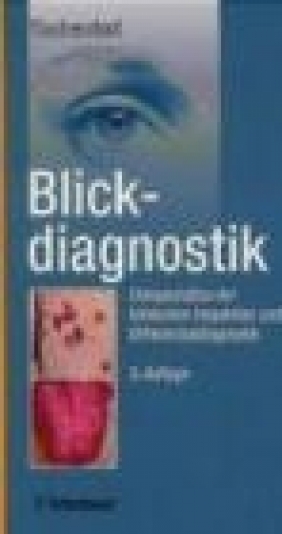 Blickdiagnostik F Tischendorf