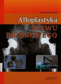 Alloplastyka stawu biodrowego