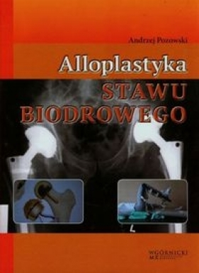 Alloplastyka stawu biodrowego - Pozowski Andrzej