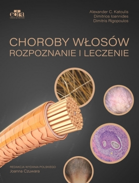 Choroby włosów. Rozpoznanie i leczenie - A. C. Katoulis, Dimitris Rigopoulos