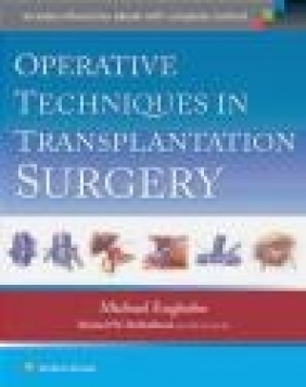 Operative Techniques in Transplant Surgery