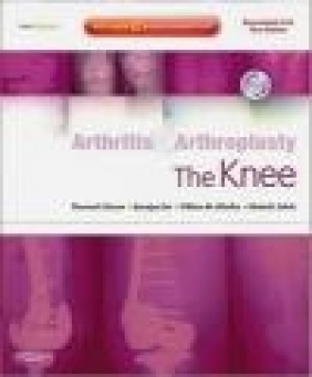 Arthritis and Arthroplasty The Knee