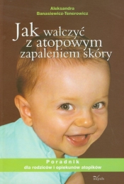 Jak walczyć z atopowym zapaleniem skóry