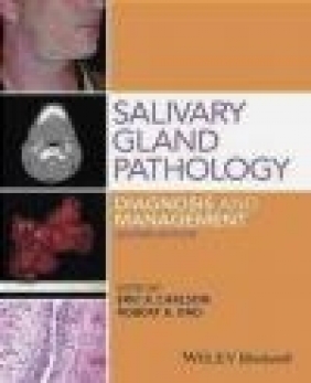 Salivary Gland Pathology Diagnosis and Management Eric Carlson, Robert Ord