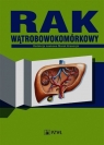 Rak wątrobowokomórkowy