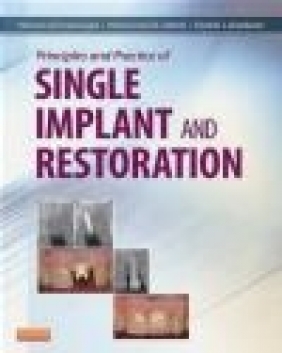 Principles and Practice of Single Implant and Restorations Mahmoud Torabinejad, Mohammed Sabeti, Charles J. Goodacre